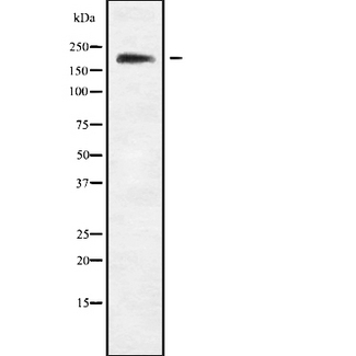 SCN9A / Nav1.7 Antibody - Western blot analysis Na+ CP type IXalpha using RAW whole cells lysates