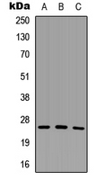 SCNM1 Antibody - Western blot analysis of SCNM1 expression in HeLa (A); Raw264.7 (B); H9C2 (C) whole cell lysates.