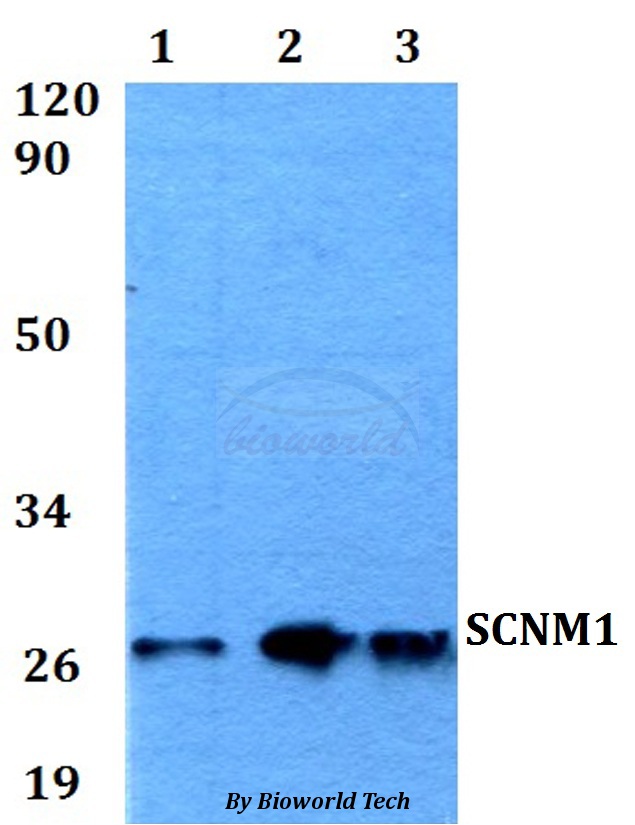 SCNM1 Antibody - Western blot of SCNM1 antibody at 1:500 dilution. Lane 1: HeLa whole cell lysate. Lane 2: Raw264.7 whole cell lysate. Lane 3: H9C2 whole cell lysate.