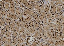 SCNM1 Antibody - 1:100 staining rat kidney tissue by IHC-P. The sample was formaldehyde fixed and a heat mediated antigen retrieval step in citrate buffer was performed. The sample was then blocked and incubated with the antibody for 1.5 hours at 22°C. An HRP conjugated goat anti-rabbit antibody was used as the secondary.