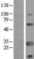SCNM1 Protein - Western validation with an anti-DDK antibody * L: Control HEK293 lysate R: Over-expression lysate