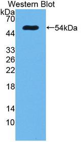 SCNN1A / ENaC Alpha Antibody - Western blot of SCNN1A / ENaC Apha antibody.