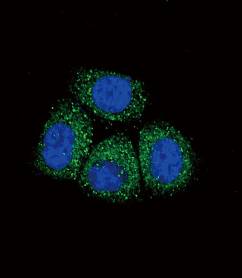 SCNN1A / ENaC Alpha Antibody - Confocal immunofluorescence of SCNN1A Antibody with HeLa cell followed by Alexa Fluor 489-conjugated goat anti-rabbit lgG (green). DAPI was used to stain the cell nuclear (blue).