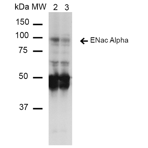 SCNN1A / ENaC Alpha Antibody - Western Blot analysis of Mouse Whole kidney homogenates showing detection of ~85kDa ENaC alpha protein using Mouse Anti-ENaC alpha Monoclonal Antibody, Clone 14E10. Lane 1: Molecular Weight Ladder (MW). Lane 2: Low-salt diet. Lane 3: Normal-salt diet. Load: 20 µg. Primary Antibody: Mouse Anti-ENaC alpha Monoclonal Antibody  at 1:1000. Predicted/Observed Size: ~85kDa.