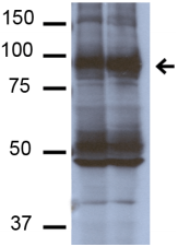 SCNN1A / ENaC Alpha Antibody - Detection of ~87kDa ENaC beta in mouse kidney homogenate with ENaCß Monoclonal Antibody at 1ug/ml.