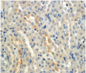 SCNN1A / ENaC Alpha Antibody - Detection of ENaC alpha in mouse kidney with ENaCa Monoclonal Antibody at 7ug/ml.