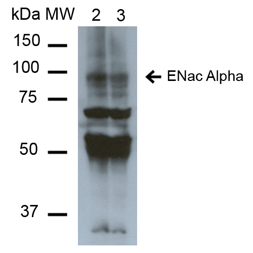 SCNN1A / ENaC Alpha Antibody - Western Blot analysis of Mouse Whole kidney homogenates showing detection of ~85kDa ENaC alpha protein using Mouse Anti-ENaC alpha Monoclonal Antibody, Clone 2G4. Lane 1: Molecular Weight Ladder (MW). Lane 2: Low-salt diet. Lane 3: Normal-salt diet. Load: 20 µg. Primary Antibody: Mouse Anti-ENaC alpha Monoclonal Antibody  at 1:1000. Predicted/Observed Size: ~85kDa.