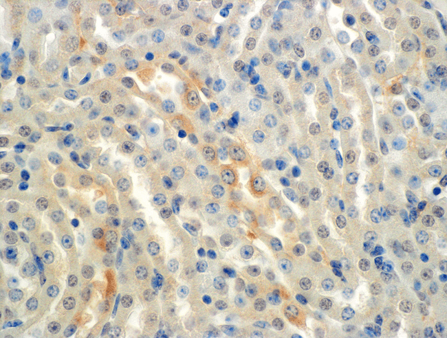 SCNN1A / ENaC Alpha Antibody - Immunohistochemistry analysis using Mouse Anti-ENaC alpha Monoclonal Antibody, Clone 2G4. Tissue: Kidney (cortex). Species: Mouse. Primary Antibody: Mouse Anti-ENaC alpha Monoclonal Antibody  at 1:150. Localization: Collecting duct principal cells. Magnification: 60X.