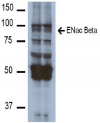 SCNN1A / ENaC Alpha Antibody - Detection of ~87kDa ENaC beta in mouse kidney homogenate with ENaCß Monoclonal Antibody at 1ug/ml.