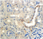 SCNN1A / ENaC Alpha Antibody - Detection of ENaC beta in mouse kidney with ENaCß Monoclonal Antibody at 7ug/ml.
