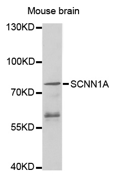 SCNN1A / ENaC Alpha Antibody - Western blot analysis of extracts of Mouse brain , using SCNN1A antibody.