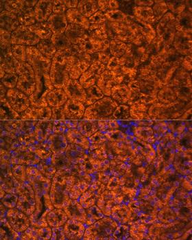 SCNN1A / ENaC Alpha Antibody - Immunofluorescence analysis of Mouse kidney cells using SCNN1A Polyclonal Antibody at dilution of 1:100.Blue: DAPI for nuclear staining.