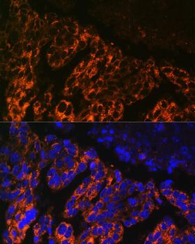 SCNN1A / ENaC Alpha Antibody - Immunofluorescence analysis of Human lung cancer cells using SCNN1A Polyclonal Antibody at dilution of 1:100.Blue: DAPI for nuclear staining.