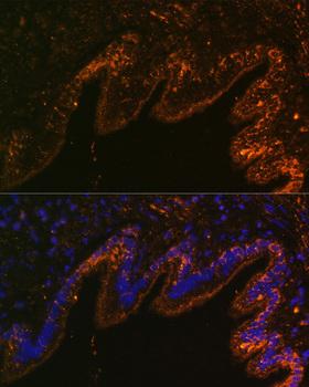 SCNN1A / ENaC Alpha Antibody - Immunofluorescence analysis of Rat lung cells using SCNN1A Polyclonal Antibody at dilution of 1:100.Blue: DAPI for nuclear staining.