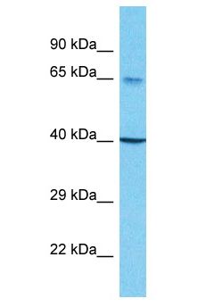 SCNN1B / ENaC Beta Antibody - SCNN1B / ENaC Beta antibody Western Blot of 721_B. Antibody dilution: 1 ug/ml.  This image was taken for the unconjugated form of this product. Other forms have not been tested.