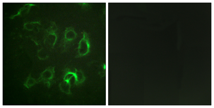 SCNN1B / ENaC Beta Antibody - Immunofluorescence analysis of HUVEC cells, using Nonvoltage-gated Sodium Channel 1 Antibody. The picture on the right is blocked with the synthesized peptide.