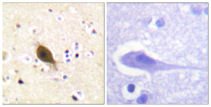 SCNN1B / ENaC Beta Antibody - Immunohistochemistry analysis of paraffin-embedded human brain tissue, using Nonvoltage-gated Sodium Channel 1 Antibody. The picture on the right is blocked with the synthesized peptide.