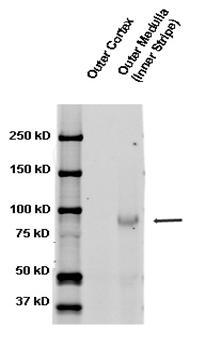 SCNN1B / ENaC Beta Antibody - Western blot analysis of ENaC beta in rat kidney tissues using a 1:1000 dilution of SCNN1B / ENaC Beta antibody.  This image was taken for the unconjugated form of this product. Other forms have not been tested.