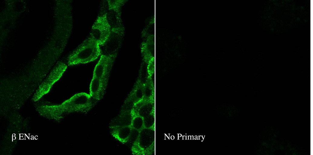 SCNN1B / ENaC Beta Antibody - IF analysis of ENaC beta in rat kidney tissues using a dilution of SCNN1B / ENaC Beta antibody.  This image was taken for the unconjugated form of this product. Other forms have not been tested.