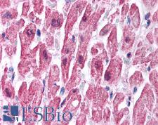 SCNN1B / ENaC Beta Antibody - Anti-SCNN1B antibody IHC of human heart. Immunohistochemistry of formalin-fixed, paraffin-embedded tissue after heat-induced antigen retrieval. Antibody concentration 2.5 ug/ml. This image was taken for the unconjugated form of this product. Other forms have not been tested.