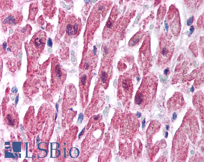 SCNN1B / ENaC Beta Antibody - Anti-SCNN1B antibody IHC of human heart. Immunohistochemistry of formalin-fixed, paraffin-embedded tissue after heat-induced antigen retrieval. Antibody concentration 2.5 ug/ml. This image was taken for the unconjugated form of this product. Other forms have not been tested.