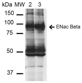 SCNN1B / ENaC Beta Antibody - Western Blot analysis of Mouse Whole kidney homogenates showing detection of ~87kDa ENaC beta protein using Mouse Anti-ENaC beta Monoclonal Antibody, Clone 16E4. Lane 1: Molecular Weight Ladder (MW). Lane 2: Low-salt diet. Lane 3: Normal-salt diet. Load: 20 µg. Primary Antibody: Mouse Anti-ENaC beta Monoclonal Antibody  at 1:1000. Predicted/Observed Size: ~87kDa.