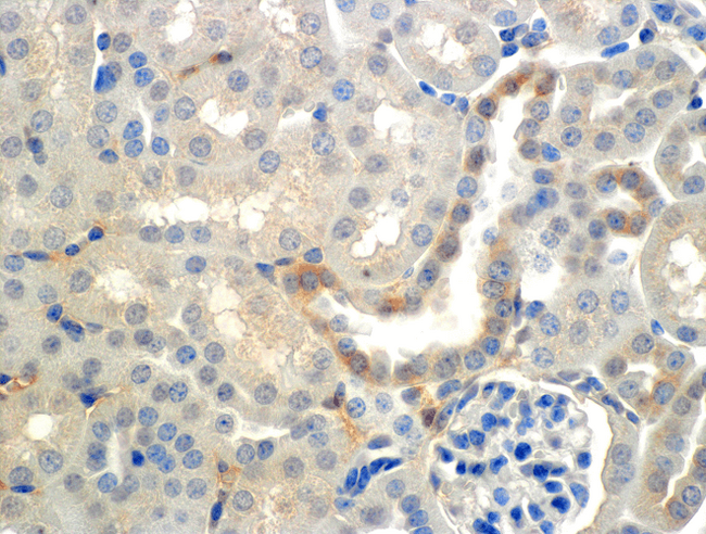 SCNN1B / ENaC Beta Antibody - Immunohistochemistry analysis using Mouse Anti-ENaC beta Monoclonal Antibody, Clone 7B8. Tissue: Kidney (cortex). Species: Mouse. Primary Antibody: Mouse Anti-ENaC beta Monoclonal Antibody  at 1:150. Localization: Collecting duct principal cells. Magnification: 60X.
