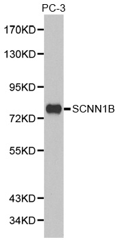 SCNN1B / ENaC Beta Antibody - Western blot analysis of extracts of PC-3 cell lines, using SCNN1B antibody.