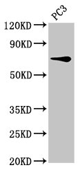 SCNN1B / ENaC Beta Antibody - Positive Western Blot detected in PC3 whole cell lysate. All lanes: SCNN1B antibody at 8 µg/ml Secondary Goat polyclonal to rabbit IgG at 1/50000 dilution. Predicted band size: 73, 78 KDa. Observed band size: 73 KDa