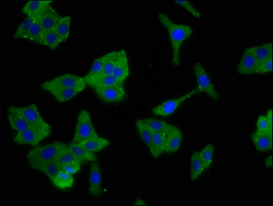 SCNN1B / ENaC Beta Antibody - Immunofluorescence staining of HepG2 cells with SCNN1B Antibody at 1:100, counter-stained with DAPI. The cells were fixed in 4% formaldehyde, permeabilized using 0.2% Triton X-100 and blocked in 10% normal Goat Serum. The cells were then incubated with the antibody overnight at 4°C. The secondary antibody was Alexa Fluor 488-congugated AffiniPure Goat Anti-Rabbit IgG(H+L).