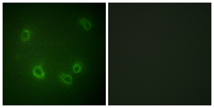 SCNN1B / ENaC Beta Antibody - Immunofluorescence analysis of COS7 cells, using Nonvoltage-gated Sodium Channel 1 (Phospho-Thr615) Antibody. The picture on the right is blocked with the phospho peptide.