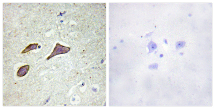 SCNN1B / ENaC Beta Antibody - Immunohistochemistry analysis of paraffin-embedded human brain, using Nonvoltage-gated Sodium Channel 1 (Phospho-Thr615) Antibody. The picture on the right is blocked with the phospho peptide.