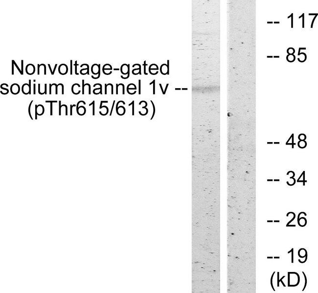 SCNN1B / ENaC Beta Antibody - Western blot analysis of lysates from HeLa cells, using Nonvoltage-gated Sodium Channel 1 (Phospho-Thr615) Antibody. The lane on the right is blocked with the phospho peptide.