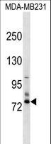 SCNN1D Antibody - SCNN1D Antibody western blot of MDA-MB231 cell line lysates (35 ug/lane). The SCNN1D antibody detected the SCNN1D protein (arrow).