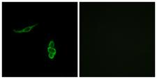 SCNN1D Antibody - Immunofluorescence analysis of A549 cells, using SCNN1D Antibody. The picture on the right is blocked with the synthesized peptide.