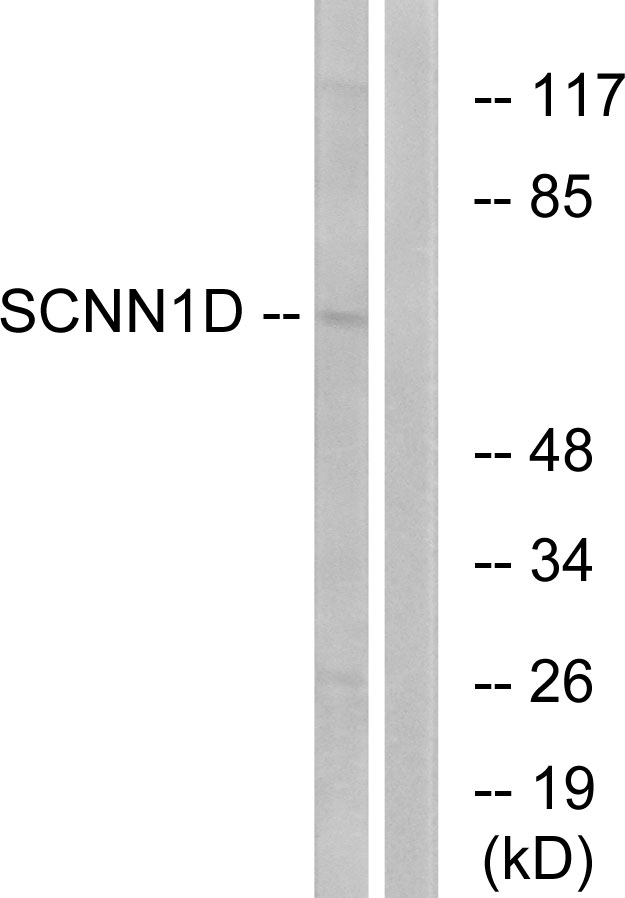 SCNN1D Antibody - Western blot analysis of lysates from RAW264.7 cells, using SCNN1D Antibody. The lane on the right is blocked with the synthesized peptide.