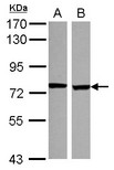 SCNN1D Antibody - Sample (30 ug of whole cell lysate) A: NT2D1 B: U87-MG 7.5% SDS PAGE SCNN1D antibody diluted at 1:1000