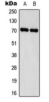 SCNN1D Antibody - Western blot analysis of Delta-NaCH expression in HEK293A (A); MDA-MB231 (B) whole cell lysates.