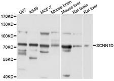 SCNN1D Antibody - Western blot analysis of extracts of various cell lines, using SCNN1D antibody at 1:1000 dilution. The secondary antibody used was an HRP Goat Anti-Rabbit IgG (H+L) at 1:10000 dilution. Lysates were loaded 25ug per lane and 3% nonfat dry milk in TBST was used for blocking. An ECL Kit was used for detection and the exposure time was 1s.