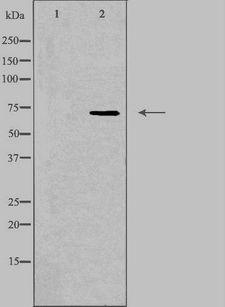 SCNN1D Antibody - Western blot analysis of extracts of RAW264.7 cells using SCNN1D antibody. The lane on the left is treated with the antigen-specific peptide.