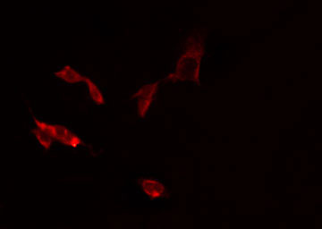 SCNN1D Antibody - Staining RAW264.7 cells by IF/ICC. The samples were fixed with PFA and permeabilized in 0.1% Triton X-100, then blocked in 10% serum for 45 min at 25°C. The primary antibody was diluted at 1:200 and incubated with the sample for 1 hour at 37°C. An Alexa Fluor 594 conjugated goat anti-rabbit IgG (H+L) antibody, diluted at 1/600, was used as secondary antibody.