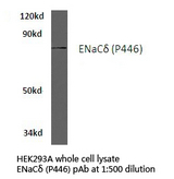 SCNN1D Antibody - Western blot of ENaC (P446) pAb in extracts from HEK293A cells.