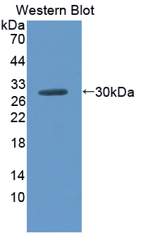 SCNN1G / ENaC Gamma Antibody - Western blot of SCNN1G / ENaC Gamma antibody.