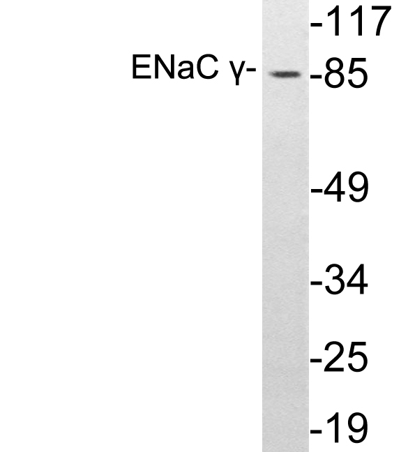 SCNN1G / ENaC Gamma Antibody - Western blot analysis of lysates from A549 cells, using ENaC Î³ antibody.