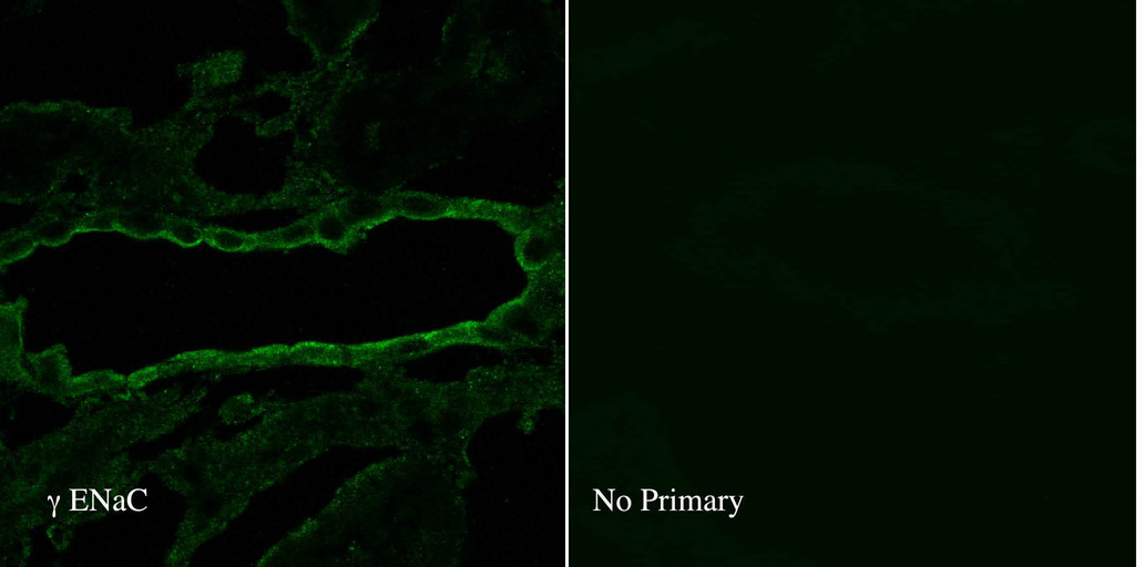 SCNN1G / ENaC Gamma Antibody - IF analysis of ENaC Gamma in rat kidney tissue using a dilution of SCNN1G / ENaC Gamma antibody.  This image was taken for the unconjugated form of this product. Other forms have not been tested.