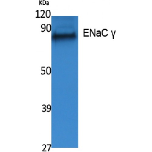 SCNN1G / ENaC Gamma Antibody - Western blot of ENaC gamma antibody