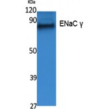 SCNN1G / ENaC Gamma Antibody - Western blot of ENaC gamma antibody
