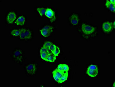 SCNN1G / ENaC Gamma Antibody - Immunofluorescent analysis of MCF-7 cells using SCNN1G Antibody at dilution of 1:100 and Alexa Fluor 488-congugated AffiniPure Goat Anti-Rabbit IgG(H+L)