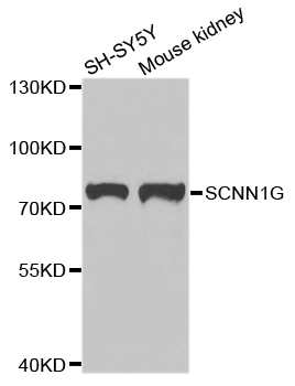 SCNN1G / ENaC Gamma Antibody - Western blot analysis of extracts of various cell lines.