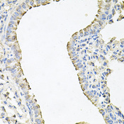 SCNN1G / ENaC Gamma Antibody - Immunohistochemistry of paraffin-embedded mouse lung tissue.
